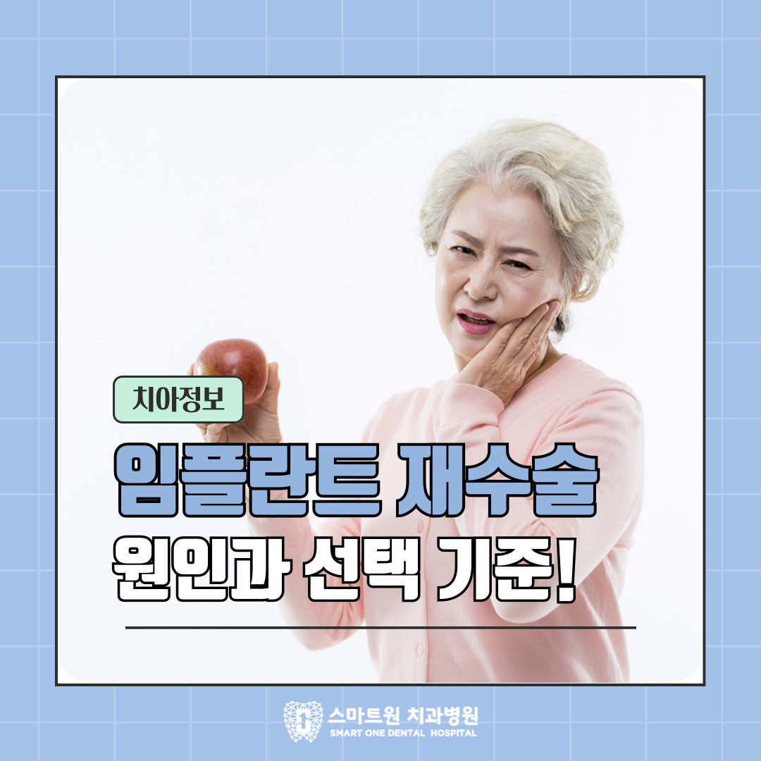 광주 임플란트 재수술, 어떤 기준으로 선택하면 좋을까?