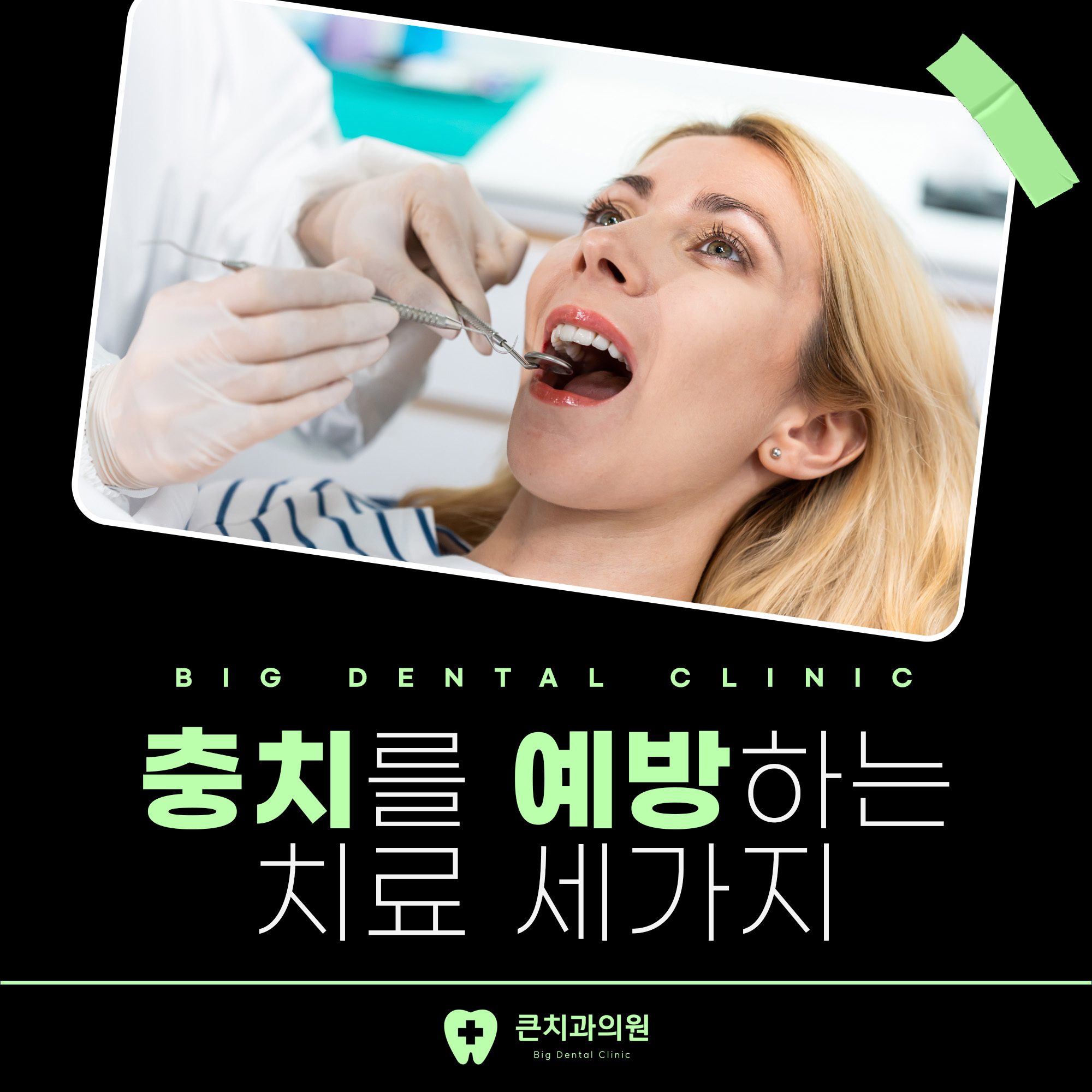 김해치과 충치를 예방하는 치료 세가지!