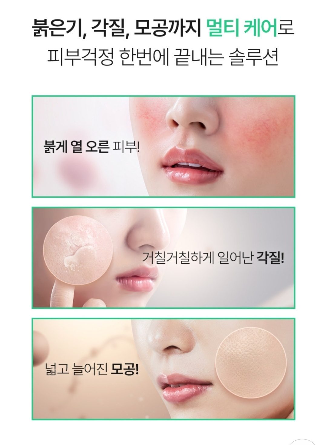 <소도몰×닥터바르고 니들샷>