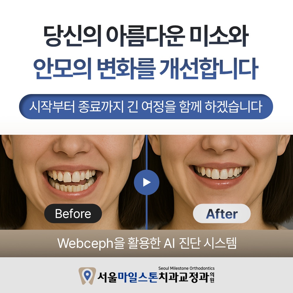 서울마일스톤치과교정과의원 picture 4