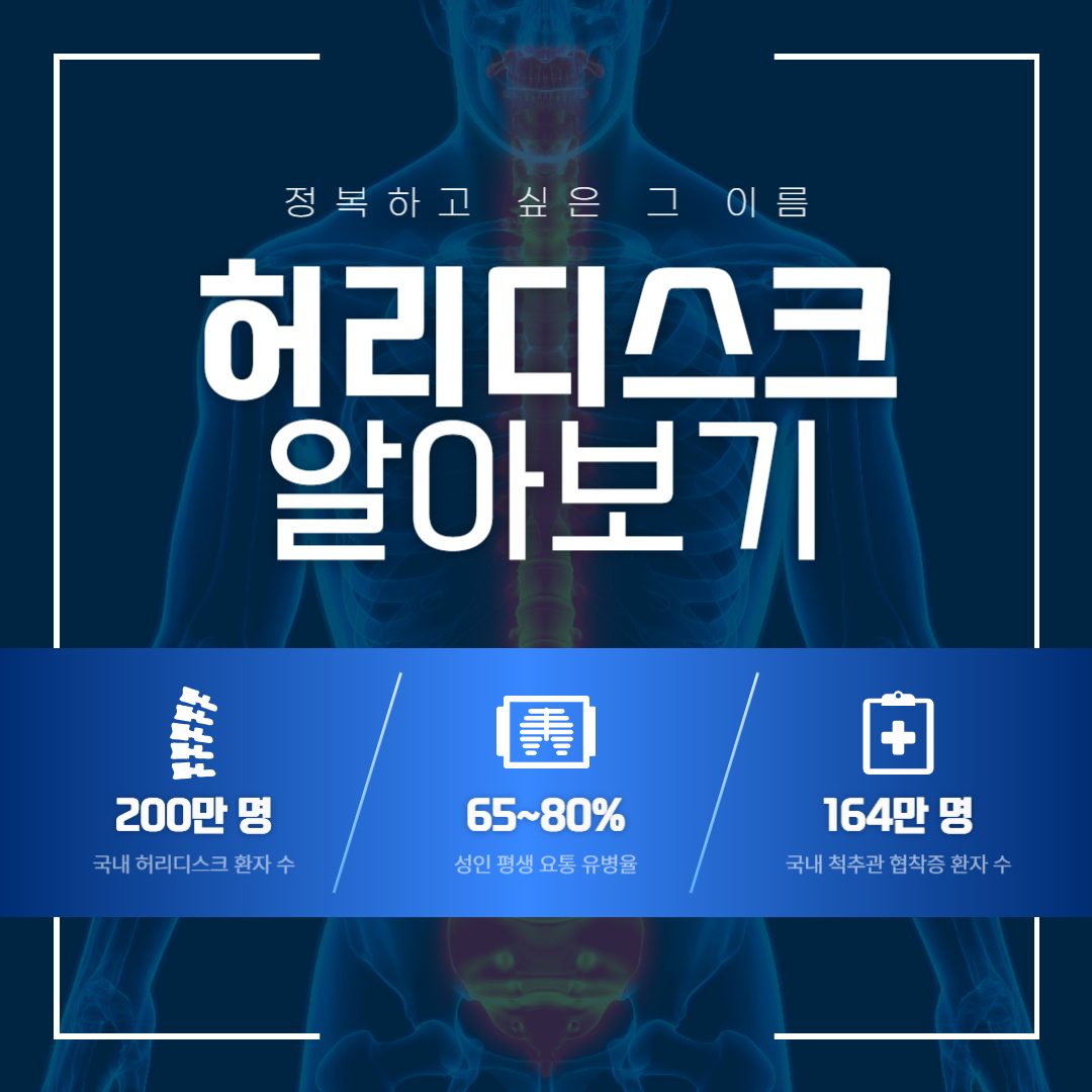 허리디스크 알아보기!