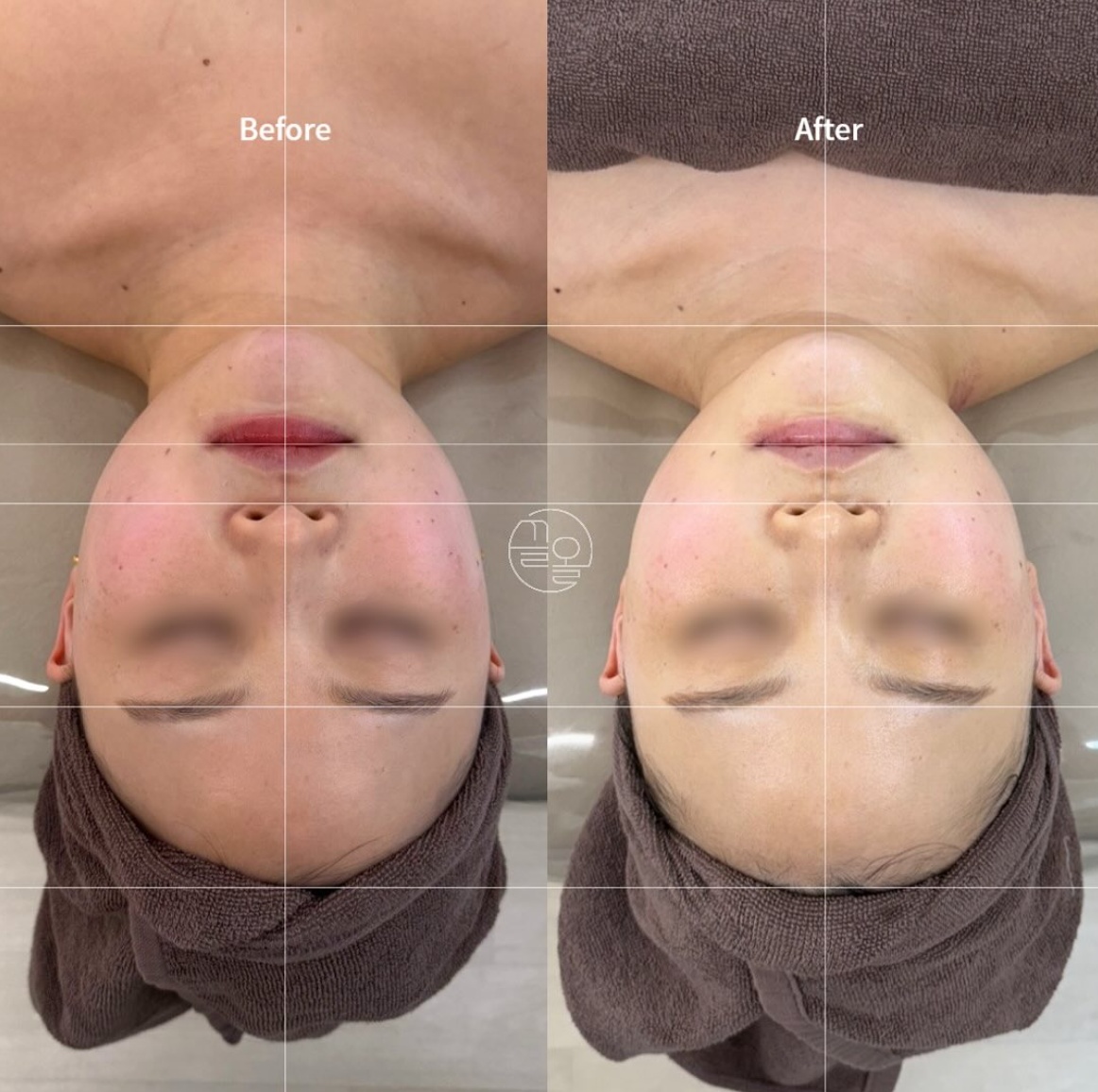 유얼핏 에스테틱 picture 9