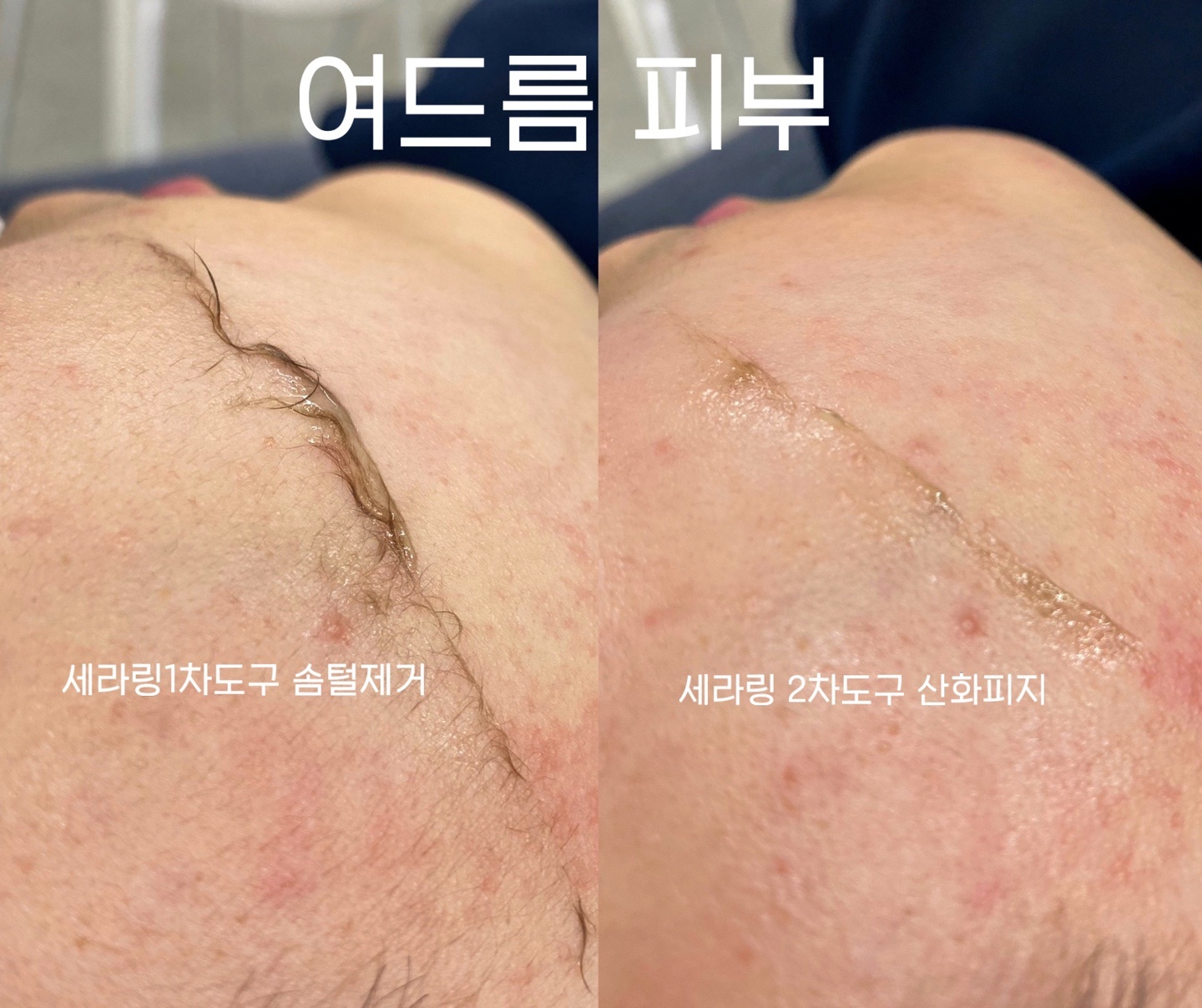 유얼핏 에스테틱 picture 0