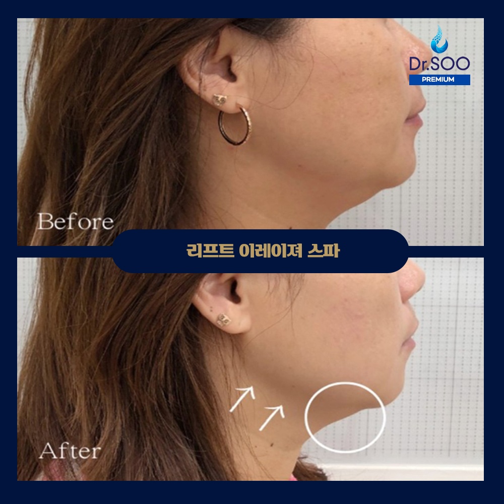 닥터수 위례 picture 3
