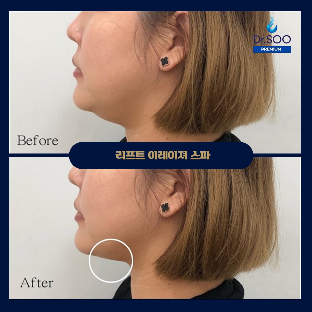 닥터수 위례 picture 4