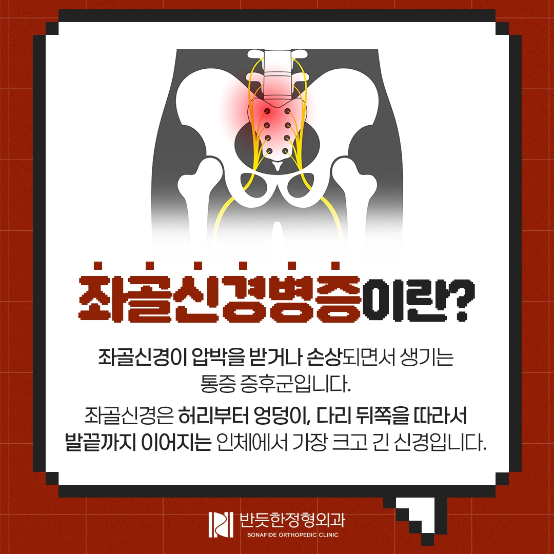 허리와 다리가 아파요. ‘좌골신경통' 알아보기 - 서울특별시 관악구 봉천동 | 비즈프로필
