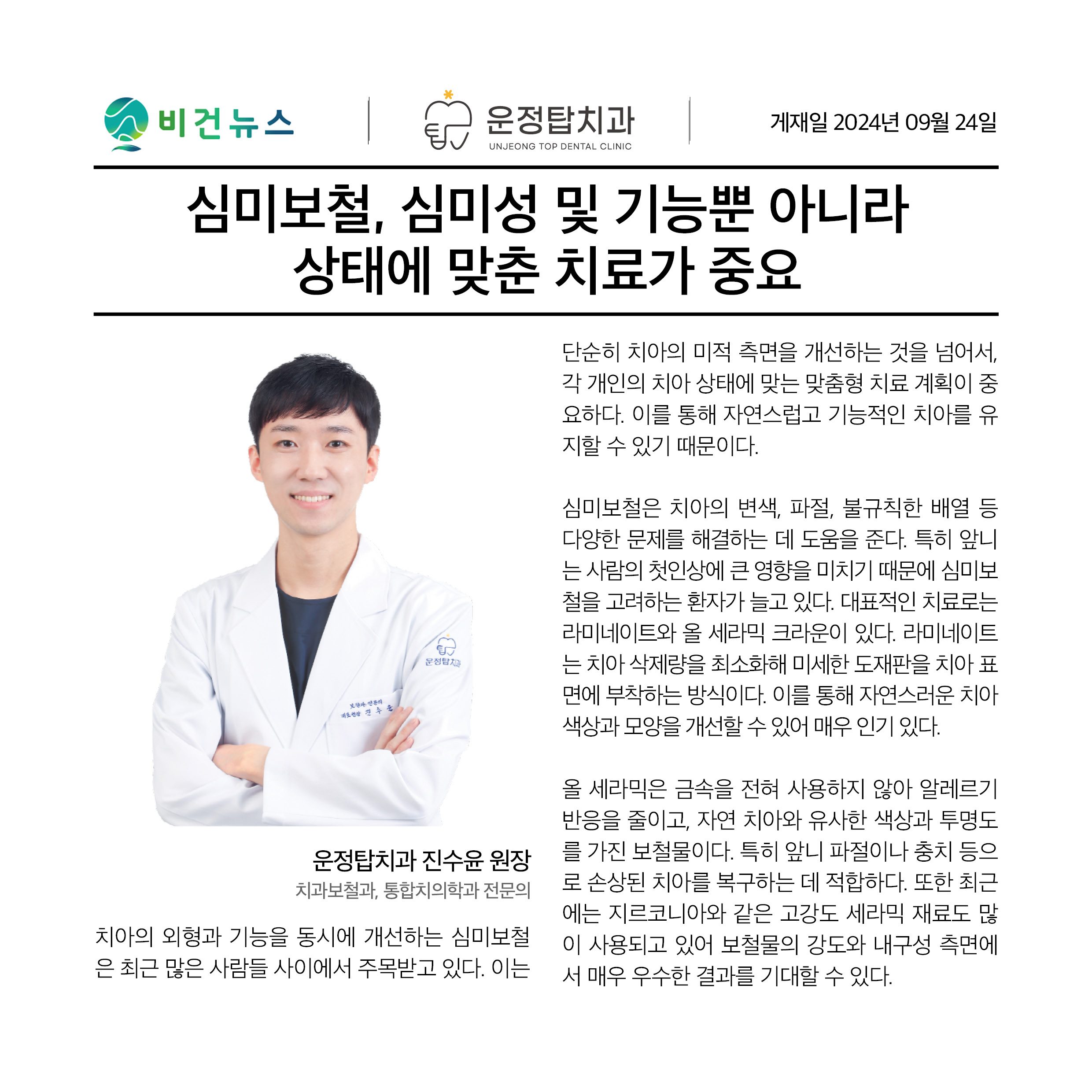 심미보철, 심미성 및 기능뿐 아니라 상태에 맞춘 치료가 중요