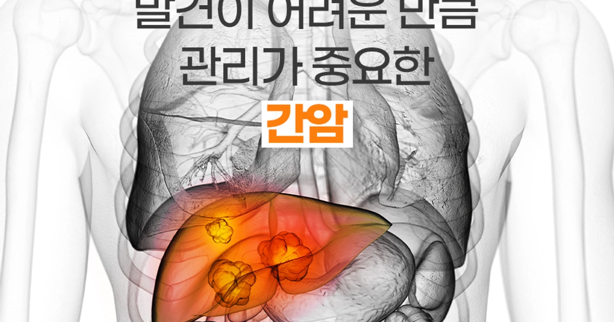 남성한테 많이 발생하는 간암 주의 | 울산광역시 남구 신정동 | 일반병원 | 당근 비즈 소식