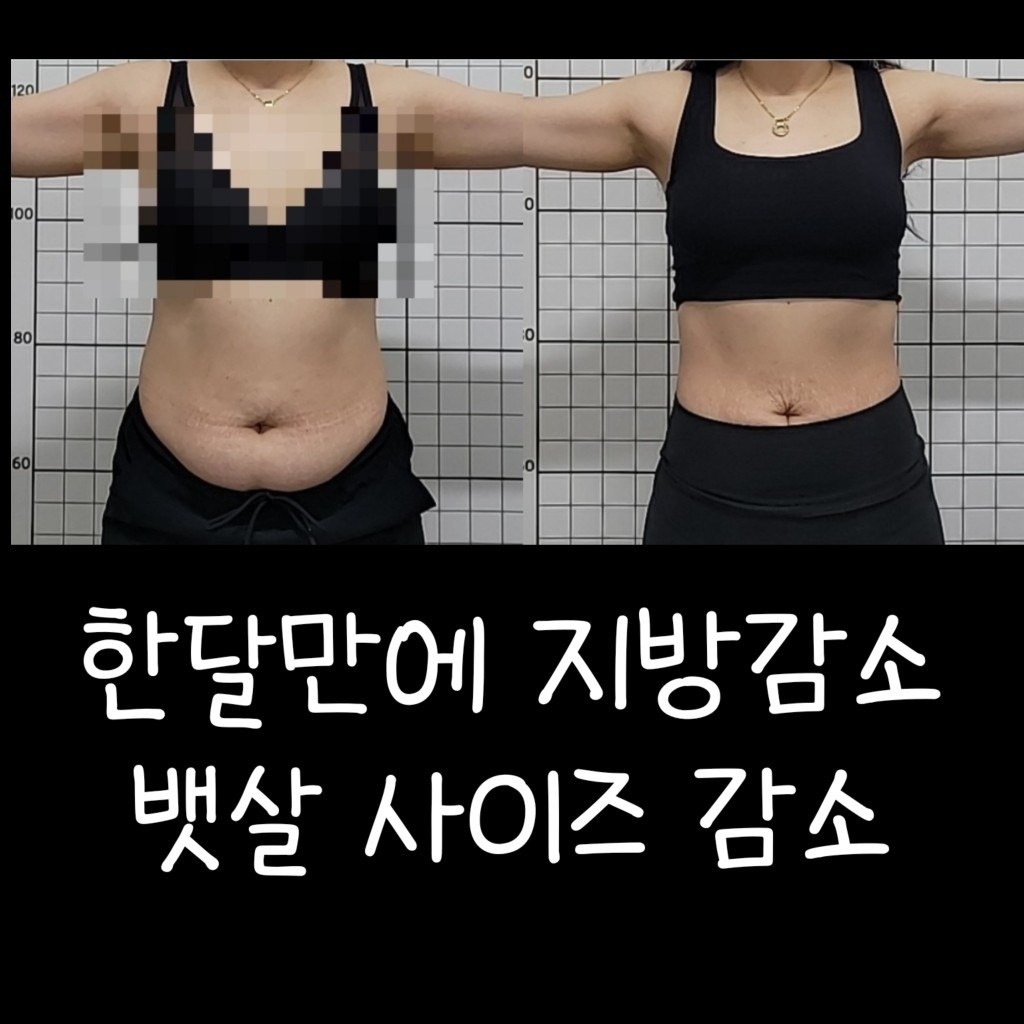 빼고온열다이어트 picture 1