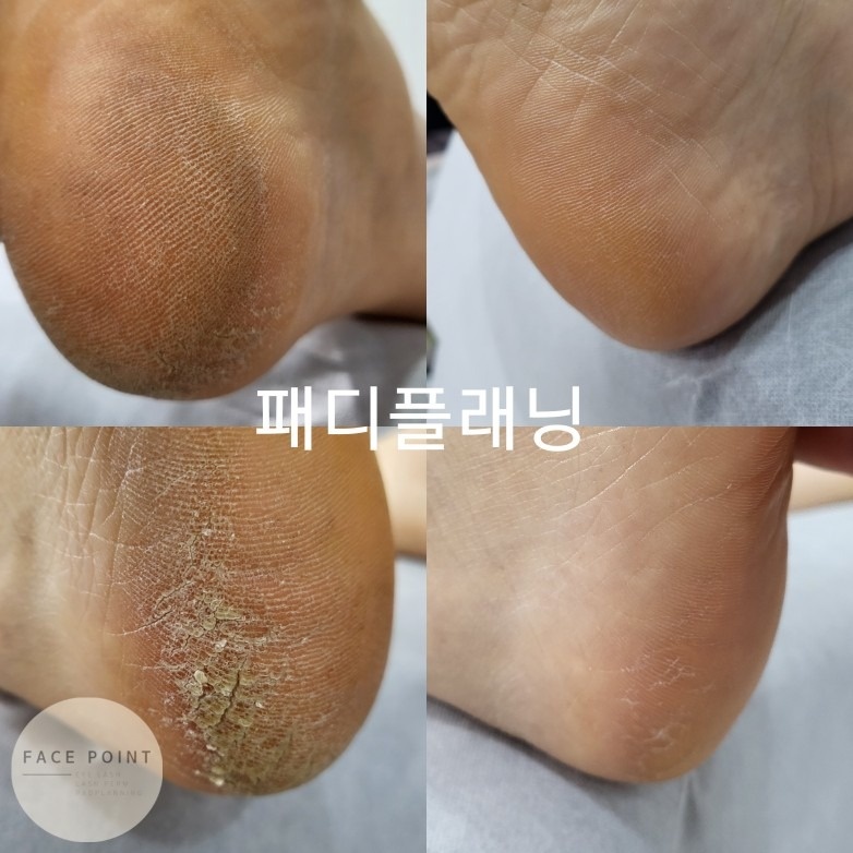 잇뷰티 picture 9