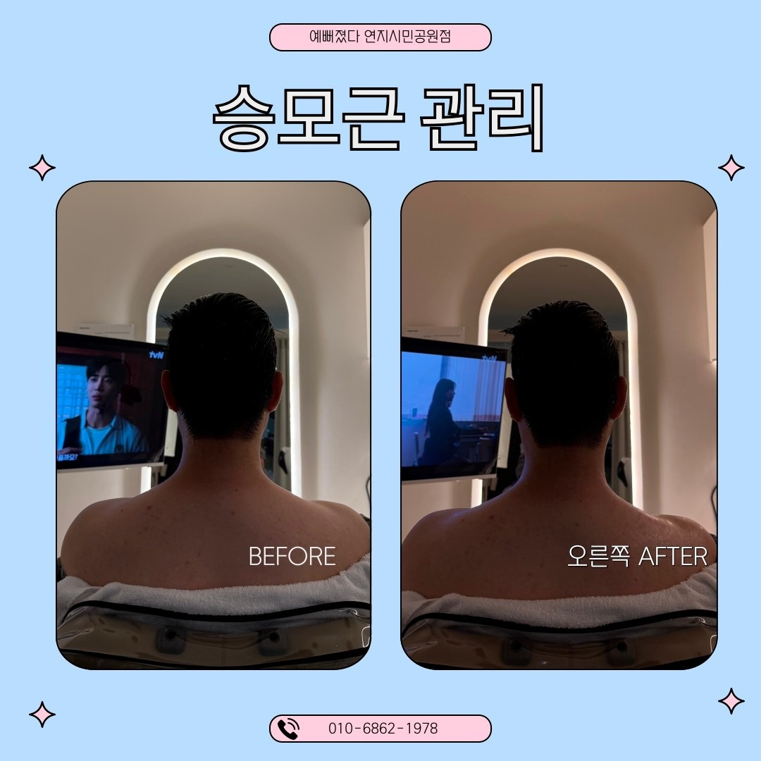 예뻐졌다 연지시민공원점 picture 2