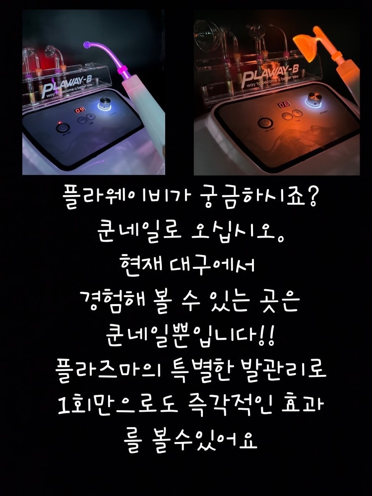 쿤네일 picture 1
