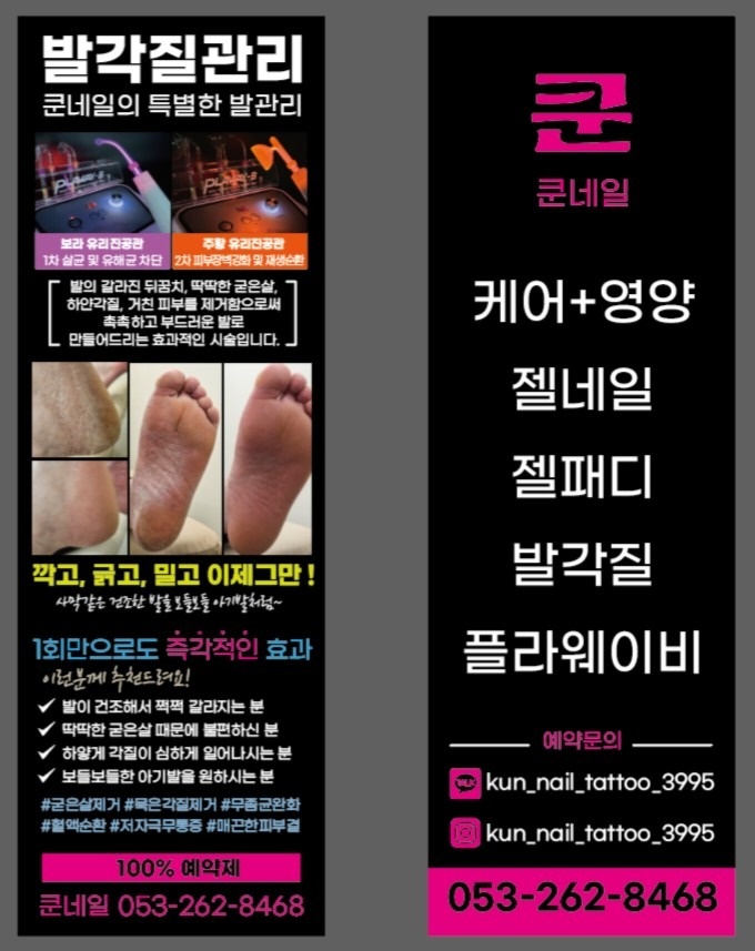 쿤네일 picture 0