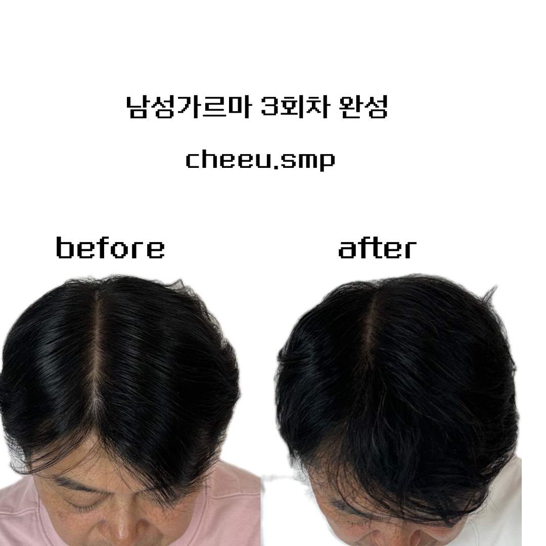 치유smp picture 0