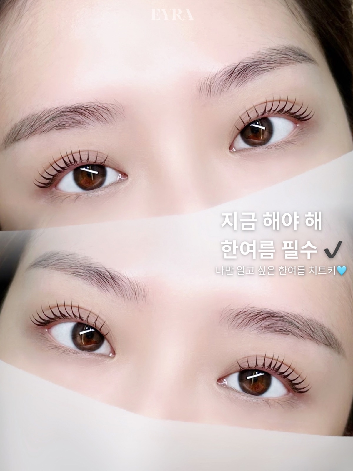 아이라EYRA picture 5