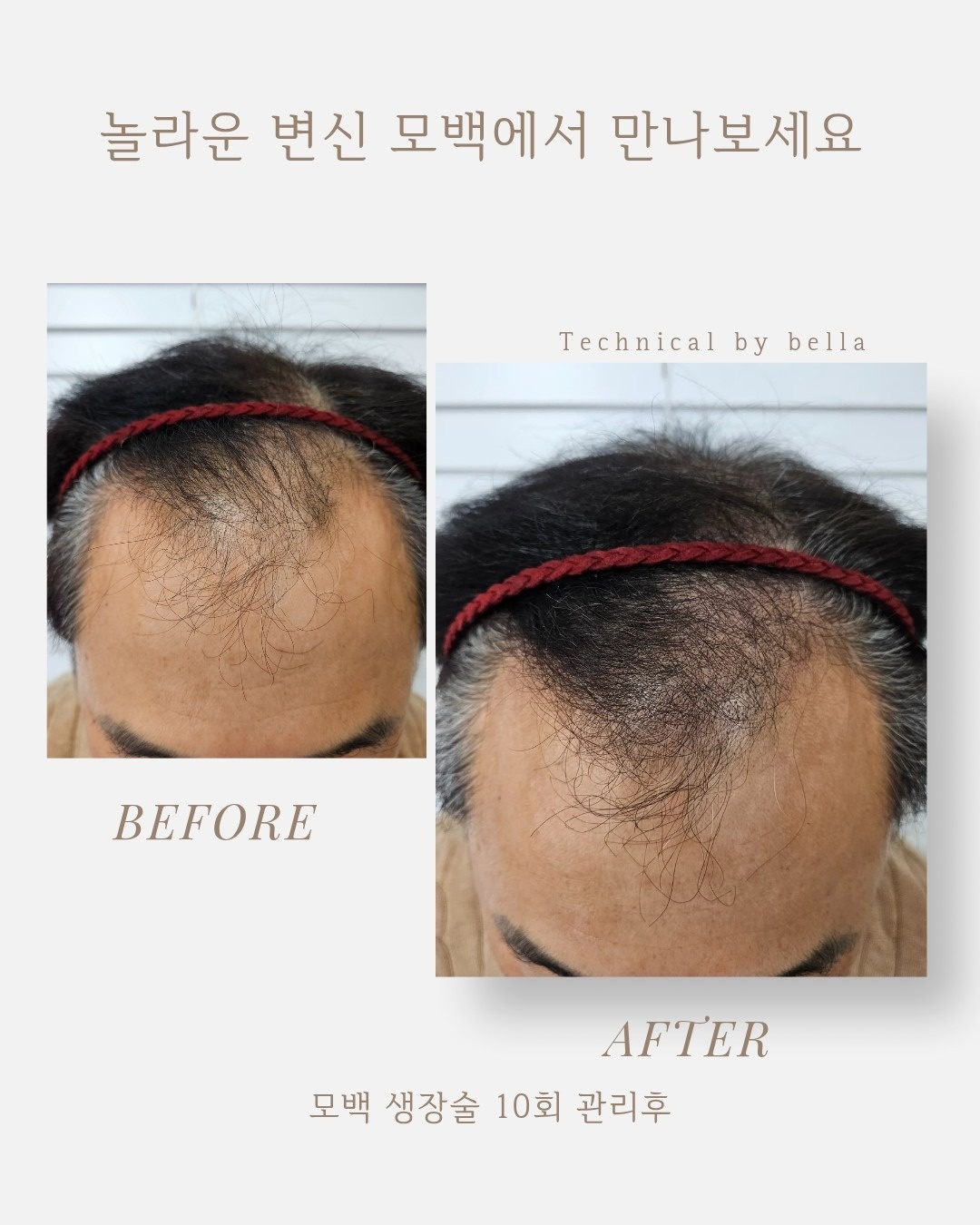 탈모관리전문점 MO100인증점 picture 1