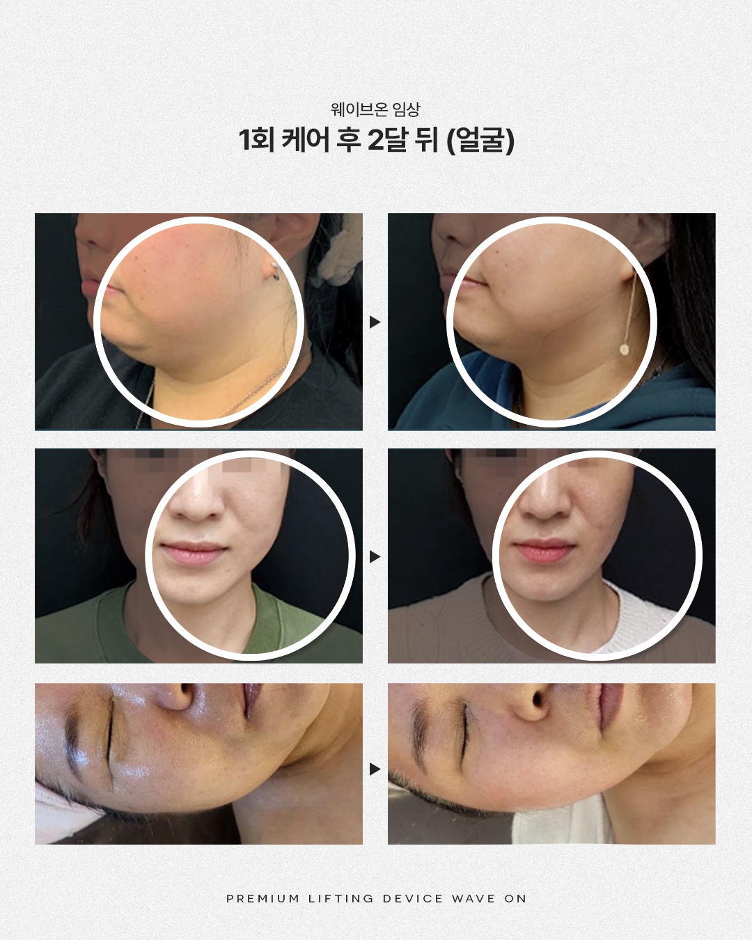 피엘스킨 마산점 picture 5