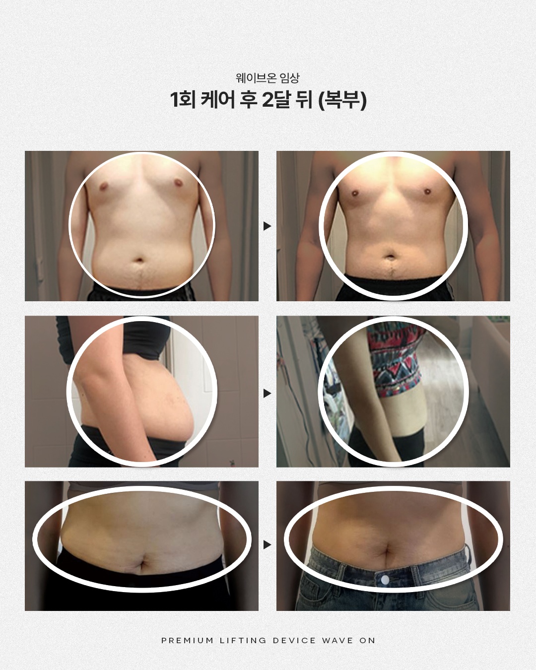 피엘스킨 마산점 picture 4