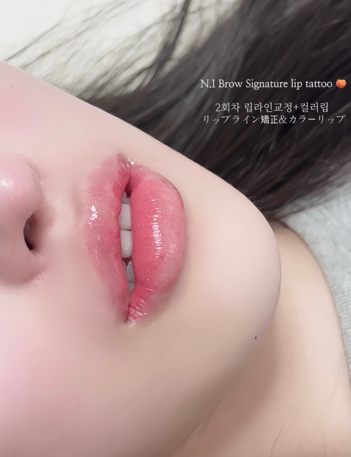 엔아이 picture 7