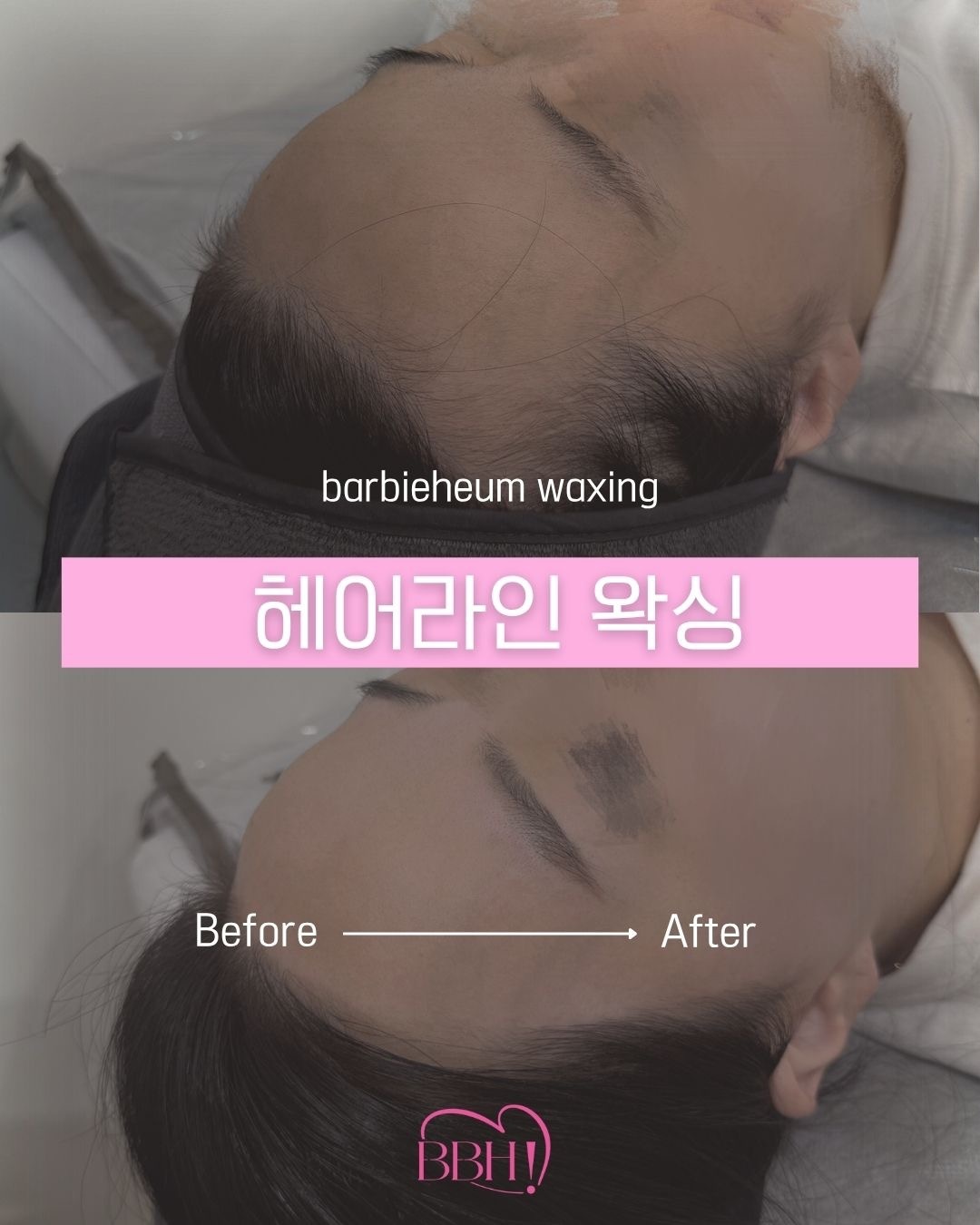 바비흠뷰티 picture 2