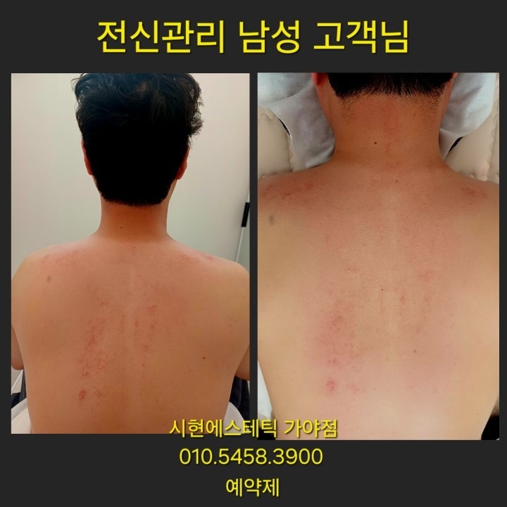 시현에스테틱 가야점 picture 9