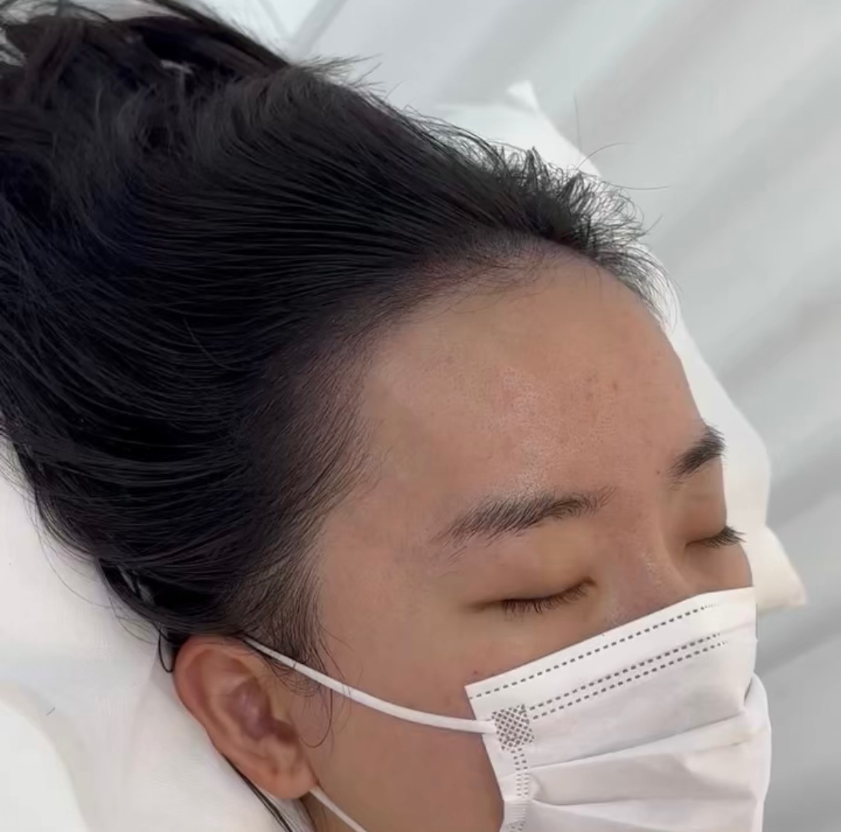 수풀림 두피관리 picture 5