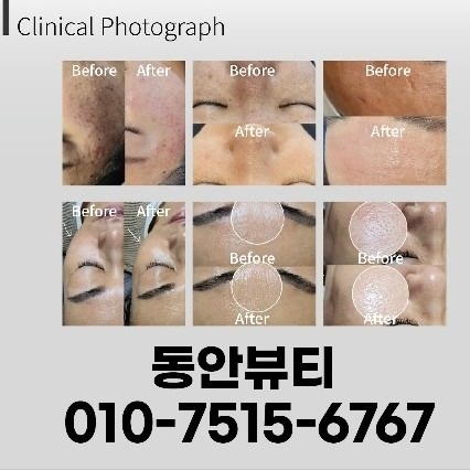 동안뷰티 picture 1