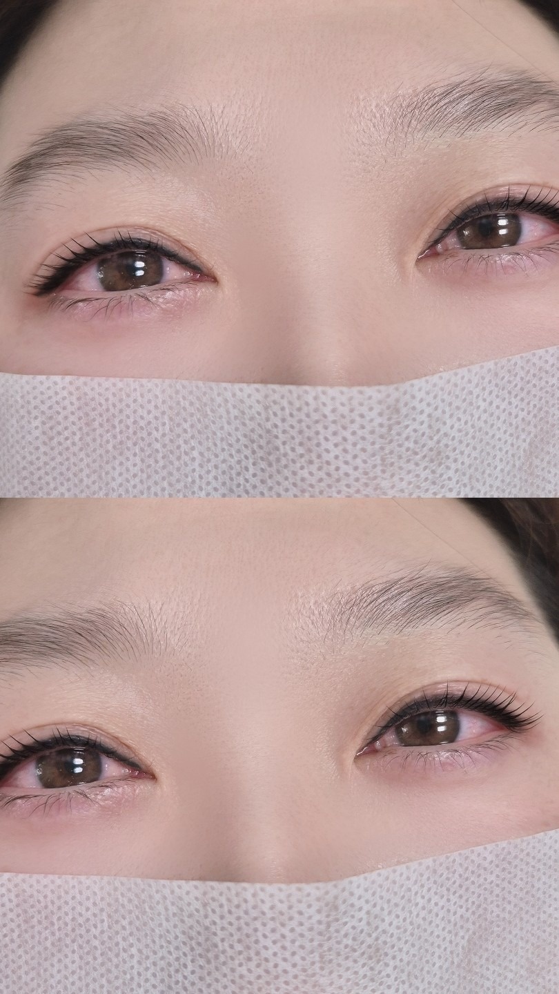 리엔아이즈 picture 5