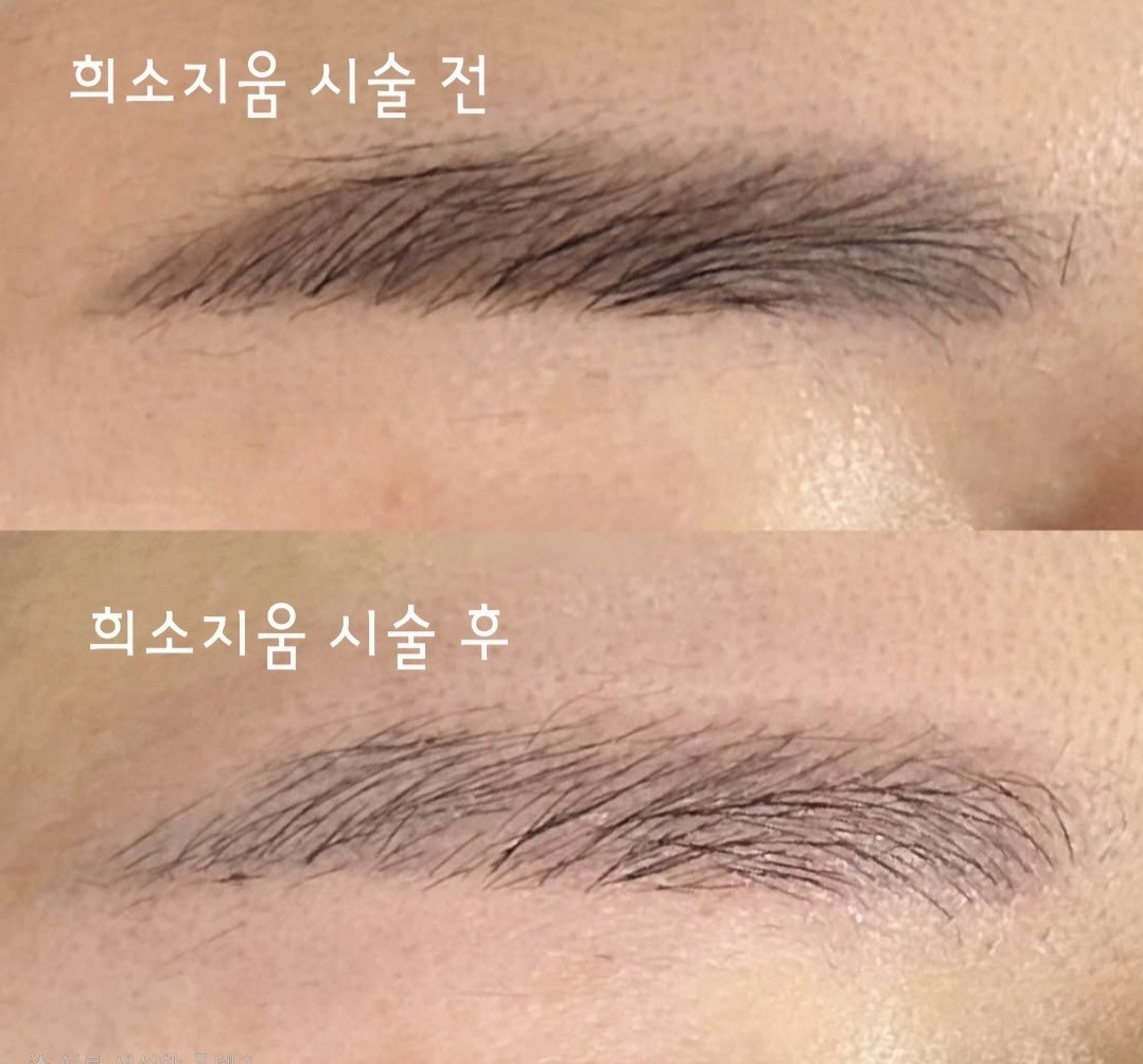 희소뷰티 picture 8