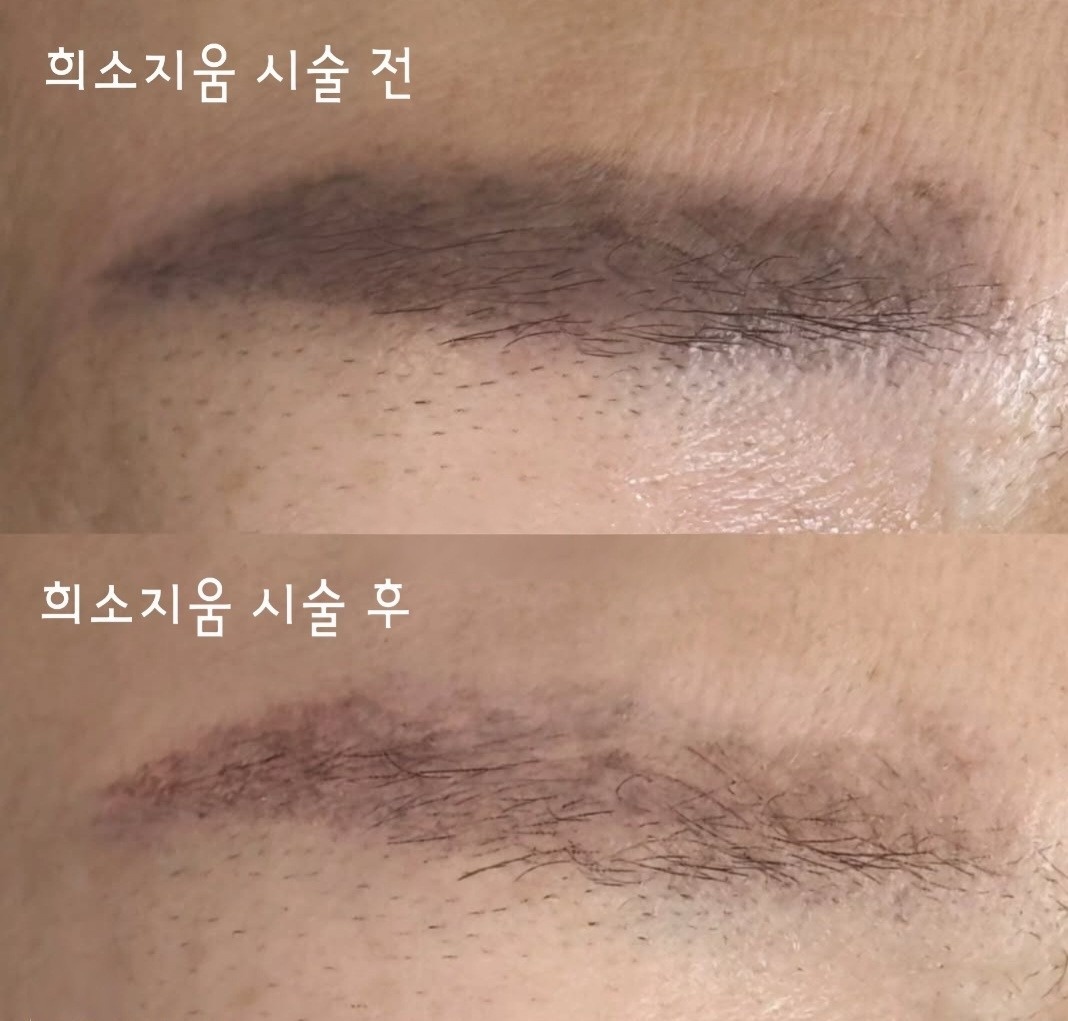 희소뷰티 picture 9