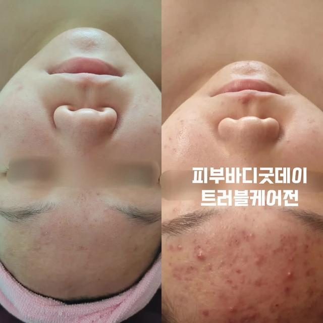 트러블관리