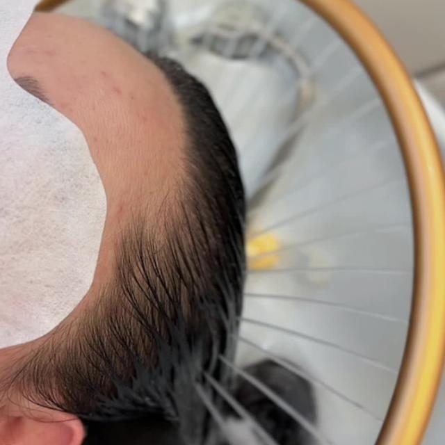 🧖‍♀️ 평생 안 해본 두피케어, 지금이 기회!