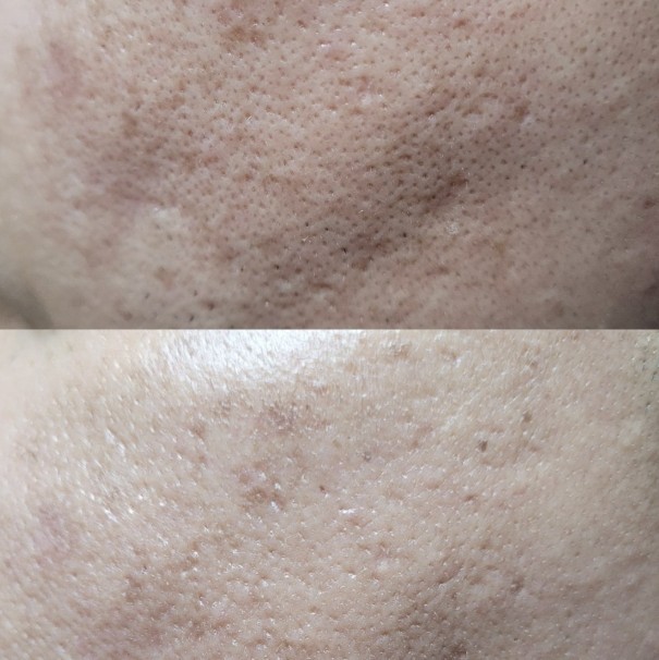 Post image 14