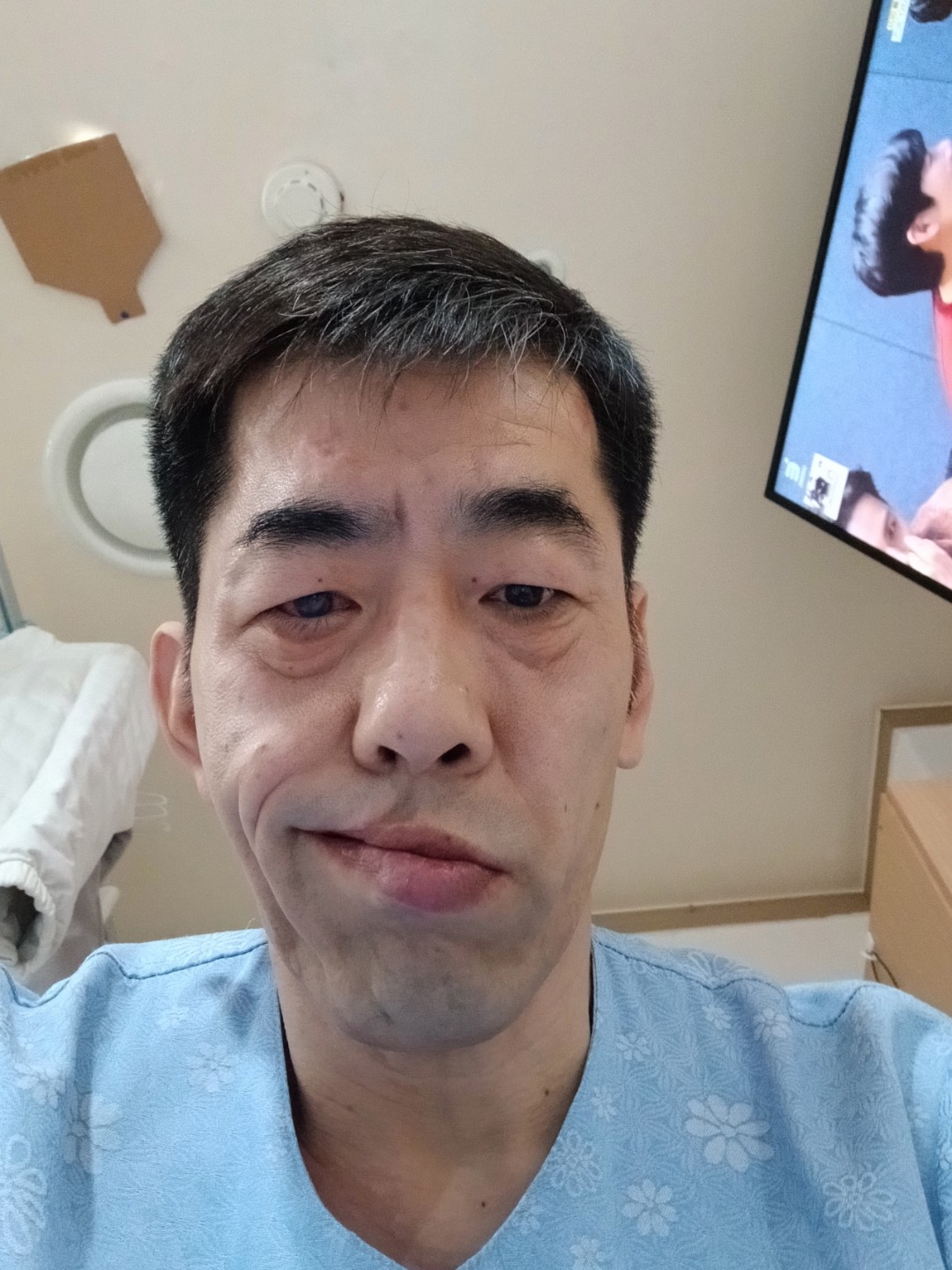 병원 생활 환자로서 고민 상담해 보아요.~~~