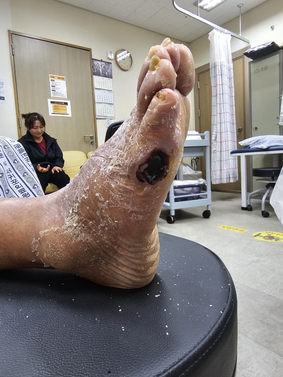 15년간 병원에서 당뇨 치료를 받은 결과