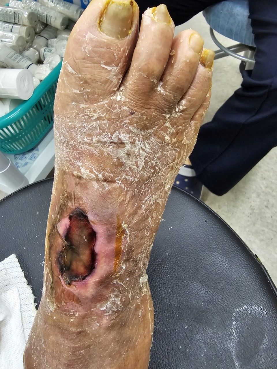 15년간 병원에서 당뇨 치료를 받은 결과