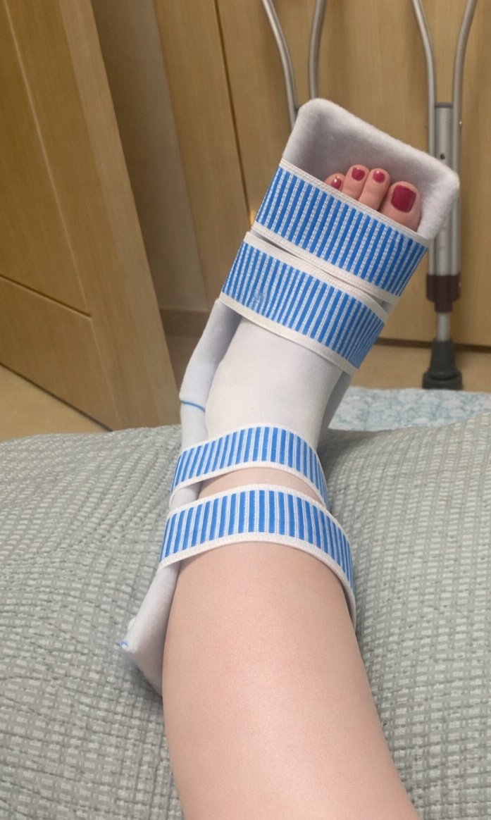 발목뼈가̐̈ 부러졌다네요ㅠㅠ