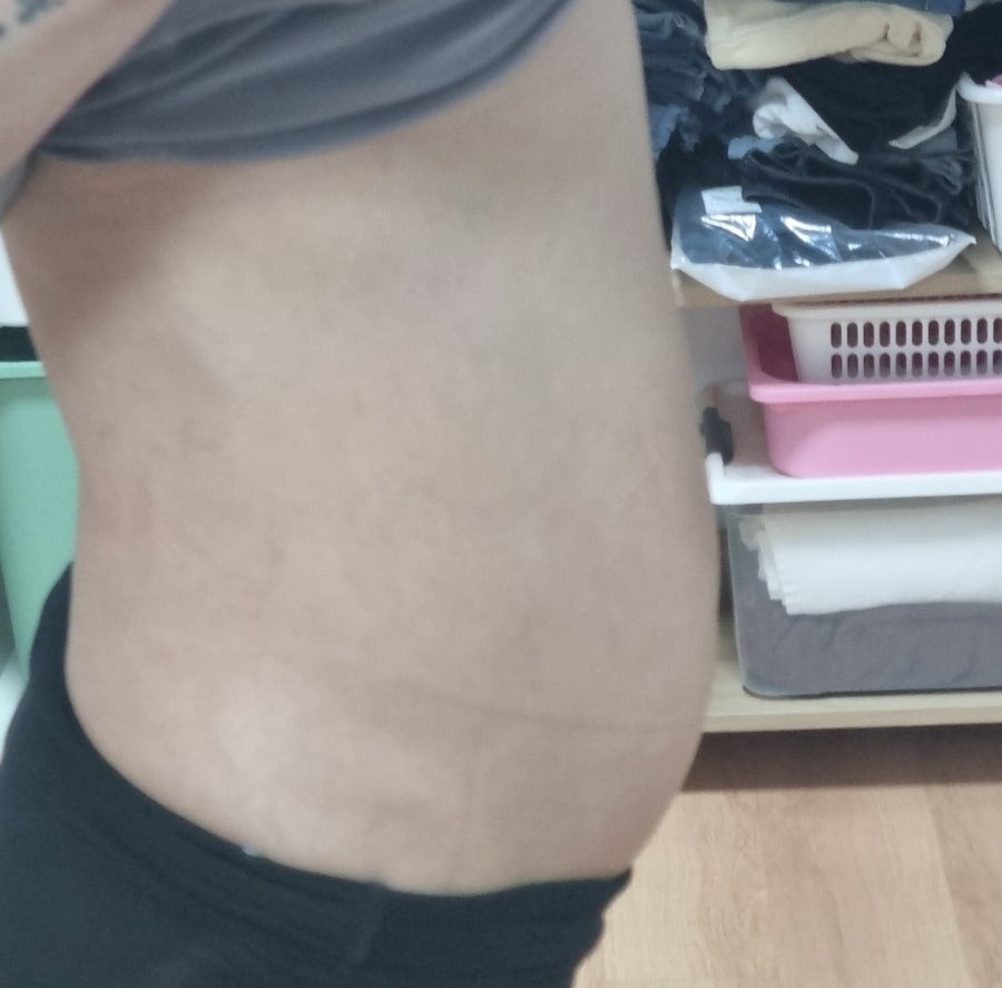 최애 다이어트 운동은? 💪