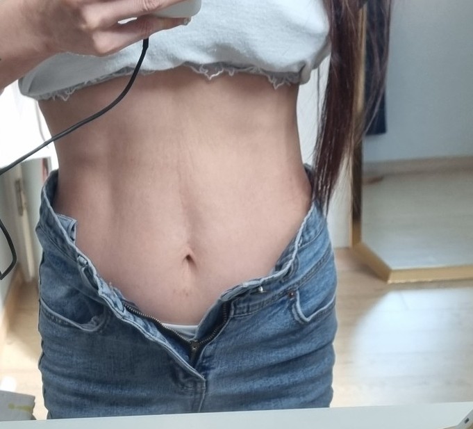 최애 다이어트 운동은? 💪