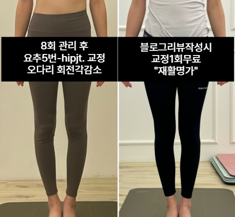 체형교정 Before & After 📸