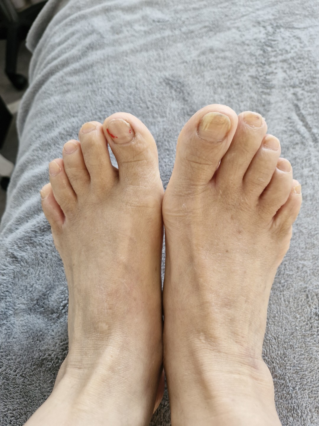 발 지압! 👣 혈액순환 UP!