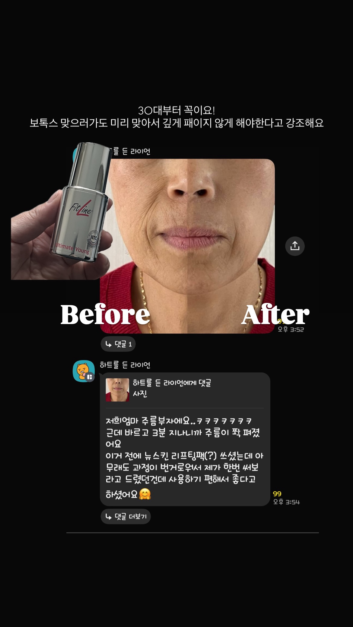 요즘 난리난 주름다리미, 단 1회 체험사례