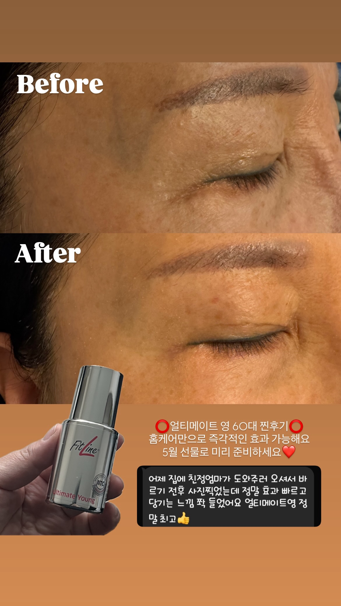 요즘 난리난 주름다리미, 단 1회 체험사례