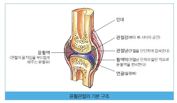 관절이 아픈 원인과 관리방법