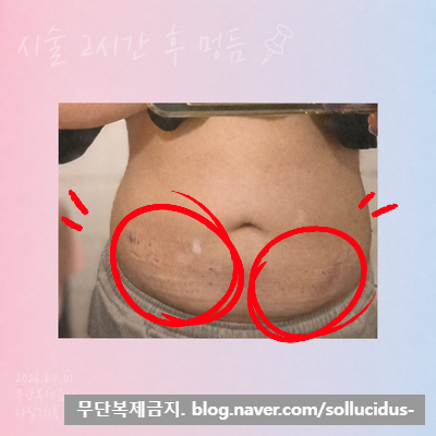 Post image 109