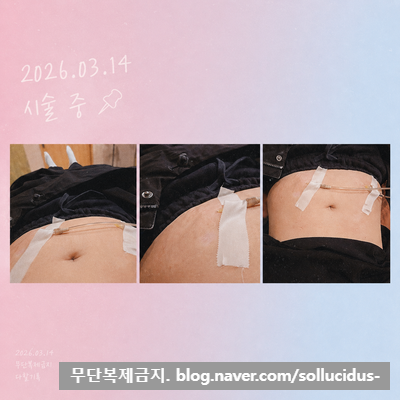 Post image 48