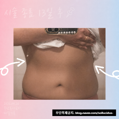 Post image 21