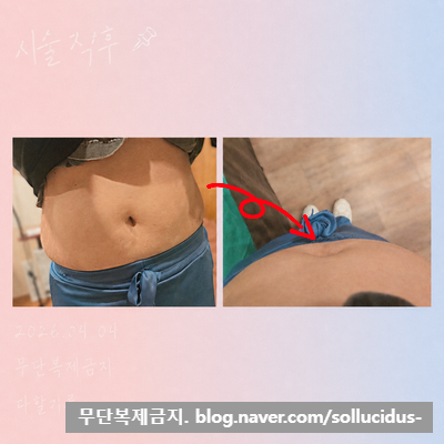 Post image 127