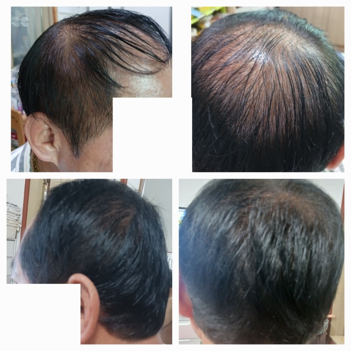 Post image 1