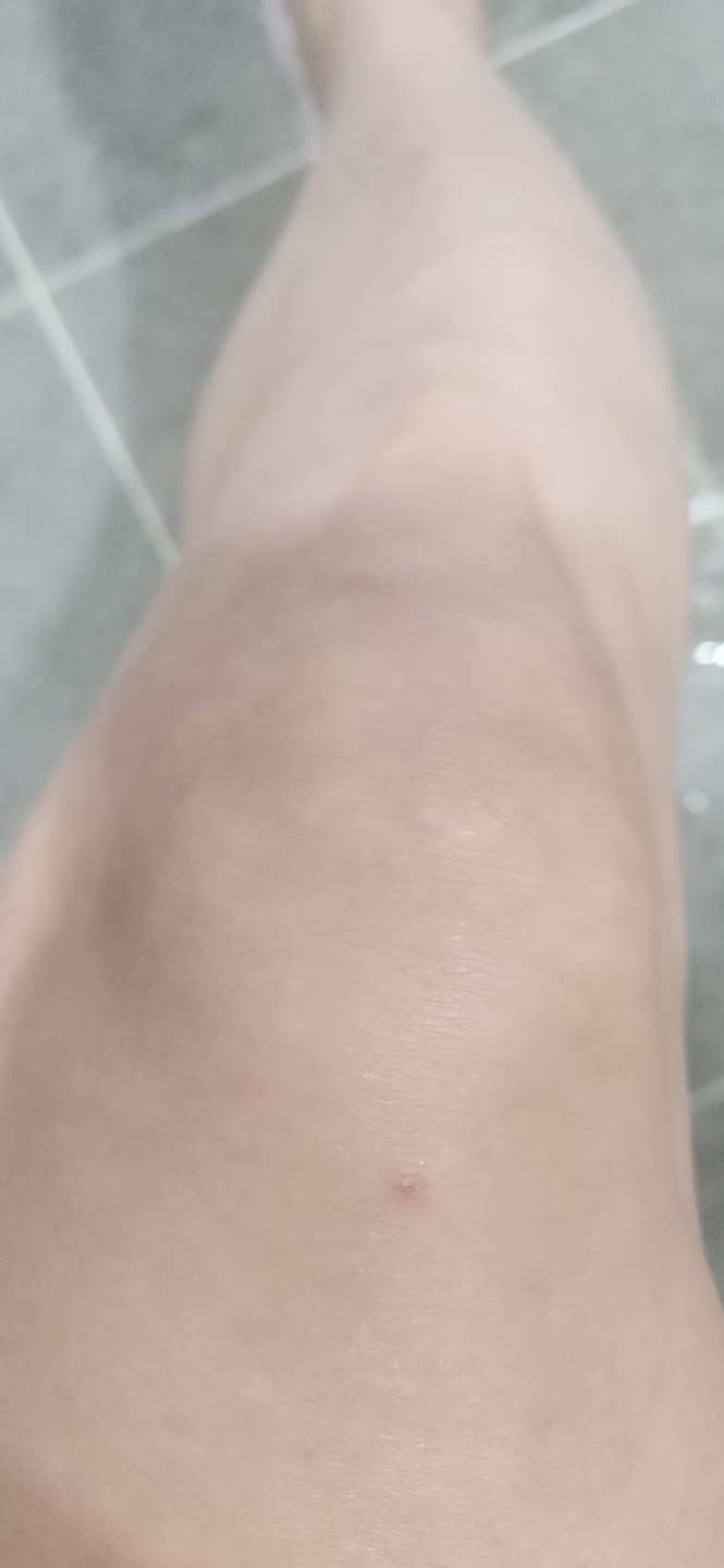Post image 6